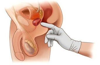 Masage prostata
