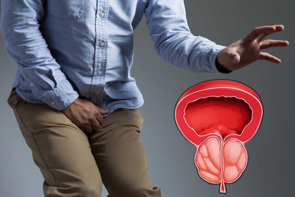 Prostatitis pri moških, ki zahteva takojšnje zdravljenje